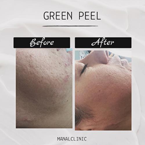 Manal Clinic Health &Beauty