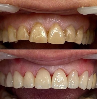 Arie smile רפואת שיניים