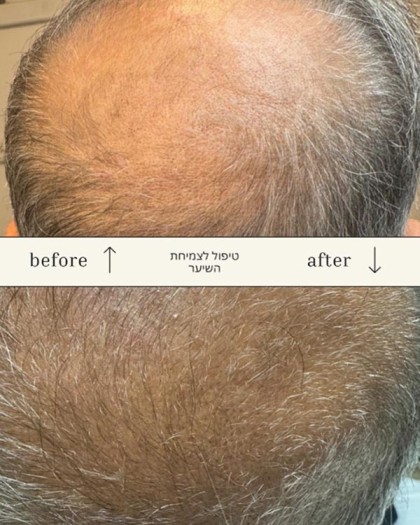 לירון קוסמטיק Liron cosmetic