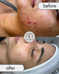 לירון קוסמטיק Liron cosmetic