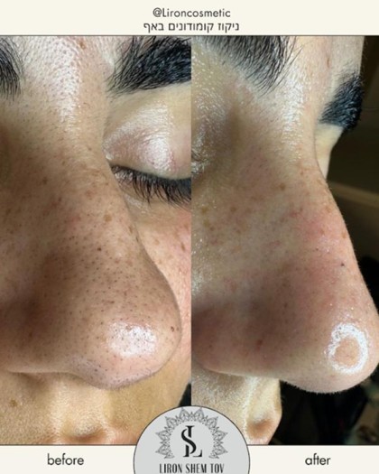 לירון קוסמטיק Liron cosmetic