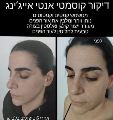צחי מגע מרפא